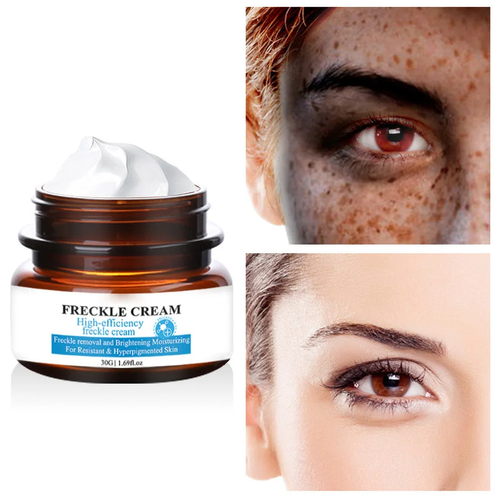 

Freckle Cream Anti-Wrinkle Anti-Aging Moisturizing Hyaluronic Acid Whisturizing Hyaluronic Acim Skin Crehishing Serum
