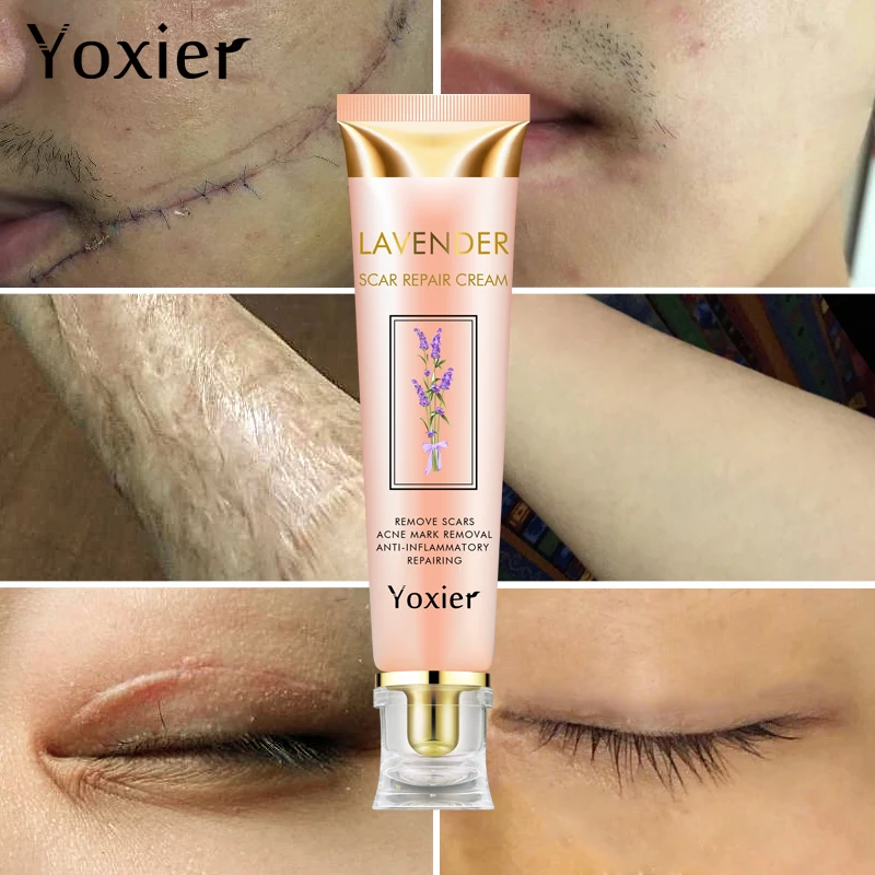 Lavender Scar Repair Cream Removal Burn Scars Promote Cell Regeneration Acne Treatment Remove Stretch Mark Smooth Skin Care | Красота и