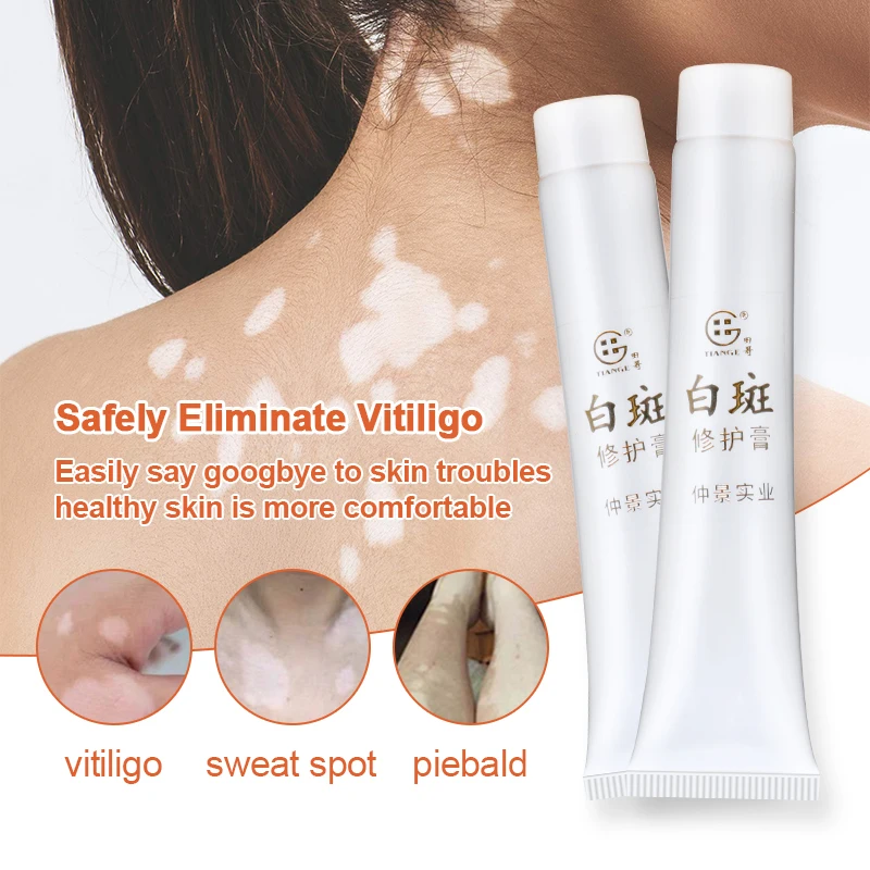 3Pcs Vitiligo Treatment Ointment White Spots Leukoplakia Disease Repair Cream Melanin Promoting Medical Plaster Health Care | Красота и