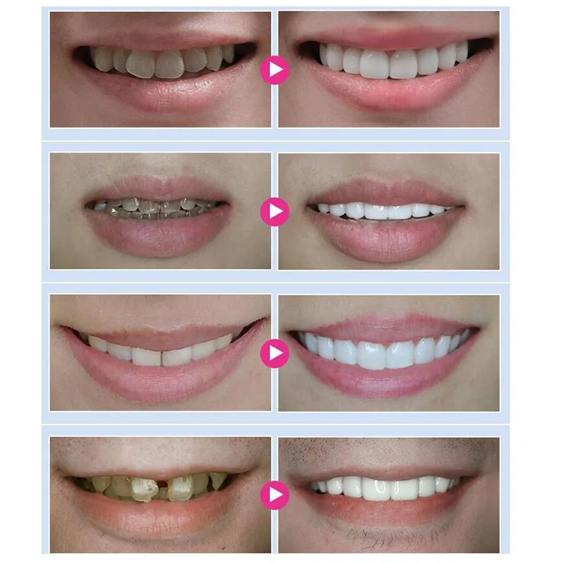 Уход за зубами отбеливания ручка для зубов очиститель 2 5 мл полостью рта гелевая