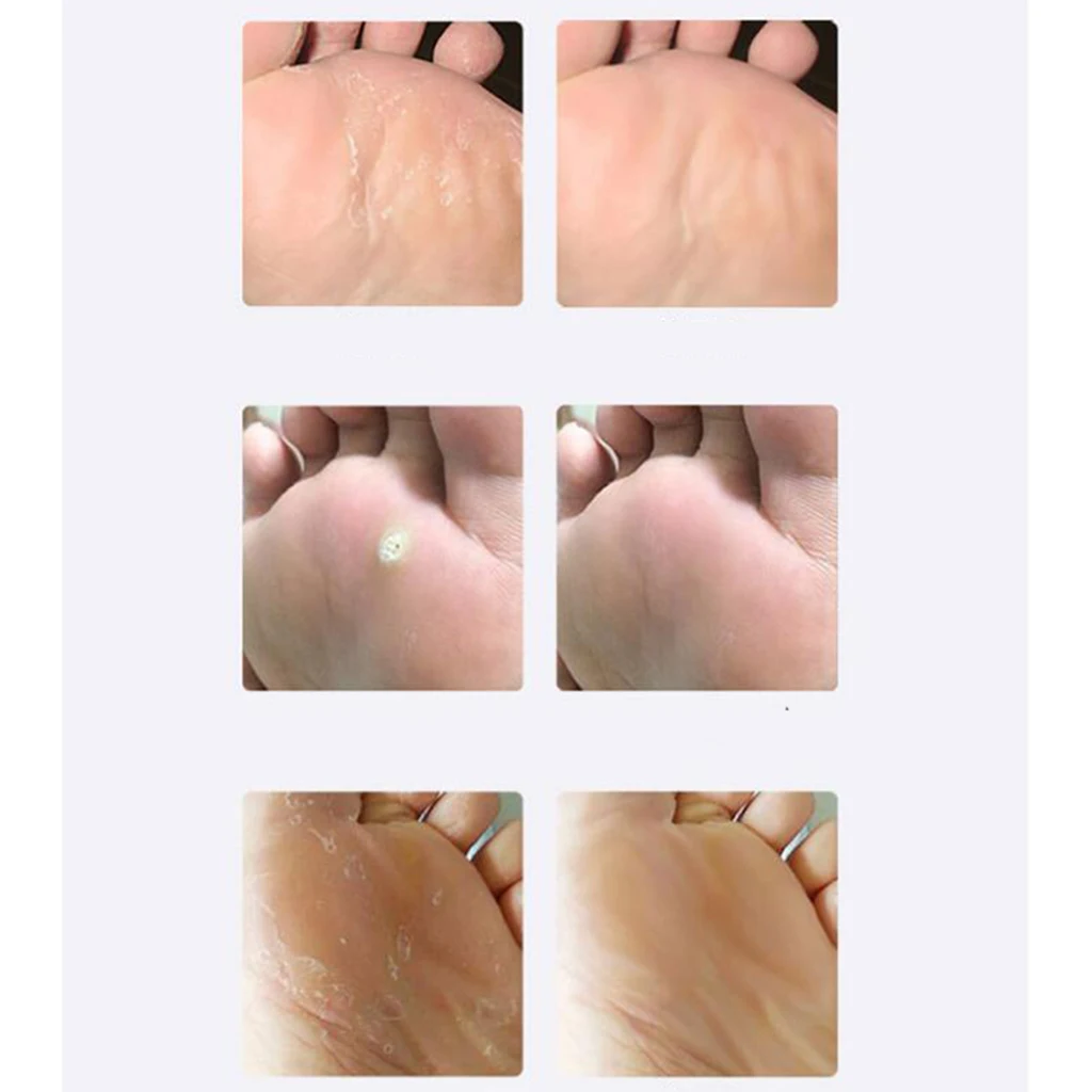 

Glass Foot File Callus Remover Hard Dead Skin Removal Rasp for Smooth Feet Skin Callus Remover Scraper Pedicure Rasp Tools