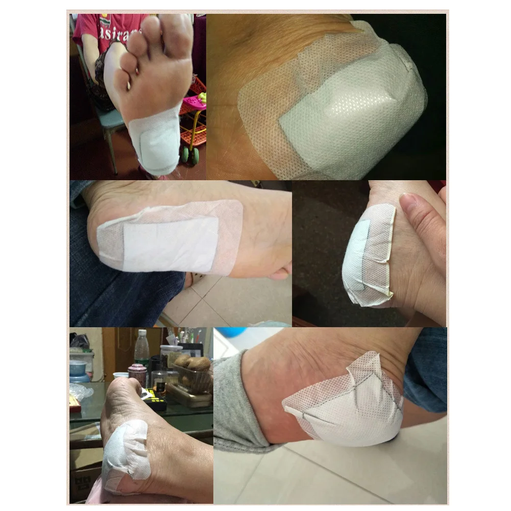 Талия Здоровье для ухода при болях рельефная Защитная Наклейка Tendonitis лечение ног