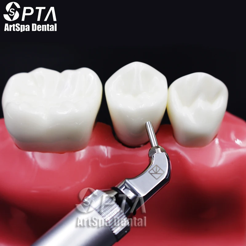 Фото SPTA стоматологический оксид, бриллиантовые пескоструйные материалы, микробластер Робсон, стоматологическая щетка, оксид алюминия, абразивн... №5
