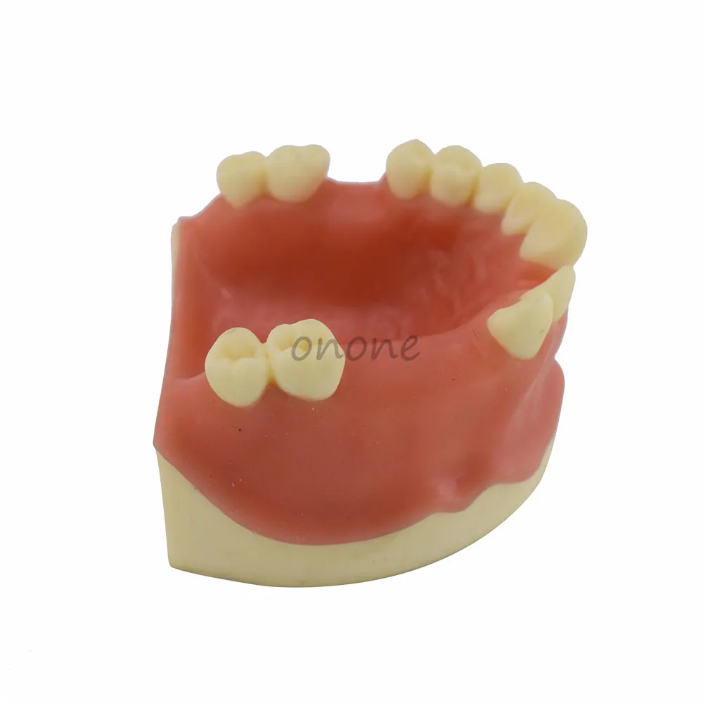 1 шт. вспомогательные средства для обучения зубам и имитации зубных имплантатов