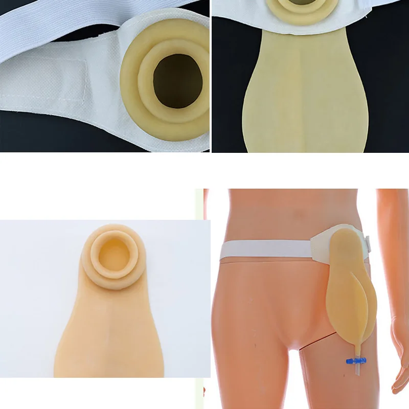 Wetips силиконовые многоразовые Стома мочеприемник писсуар Портативный мочевой