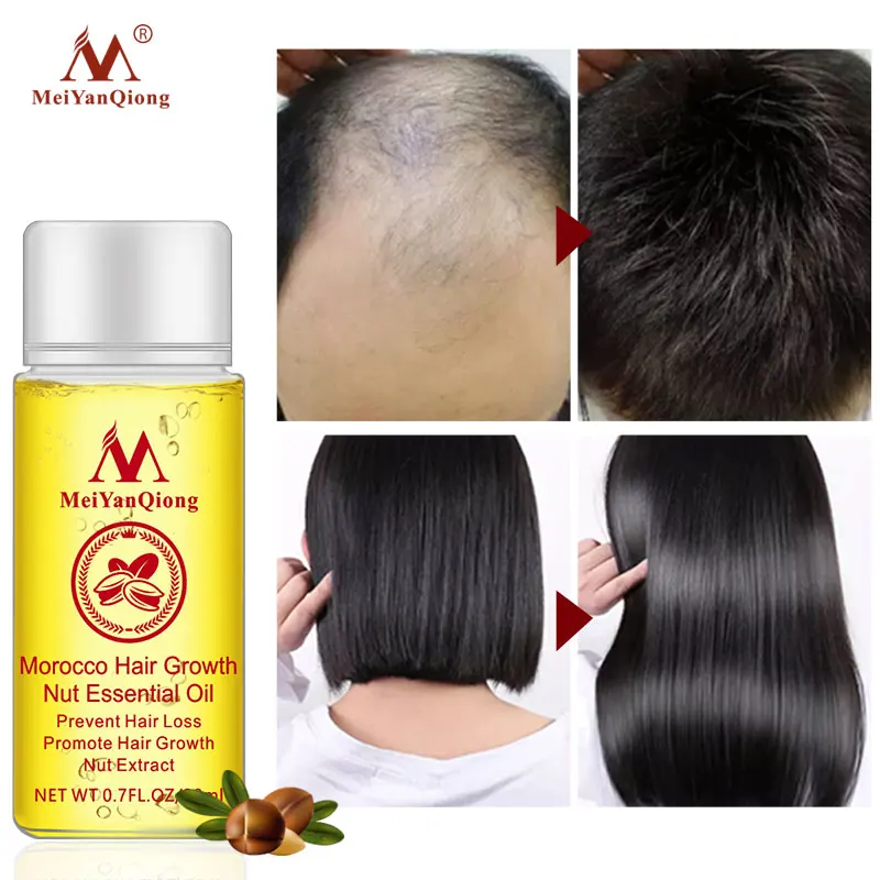 Новое поступление продукции для роста волос Andrea имбирное масло быстрого