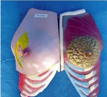 

Female Breast Model Health and Sick Breast Anatomy Model Female Genital Anatomical Model Pathological Breast Medical Teaching