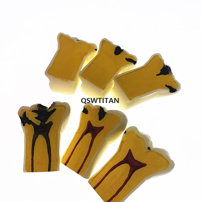 В 4 раза кариеса Comparation модели зубов Модель обучения научно исследовательских