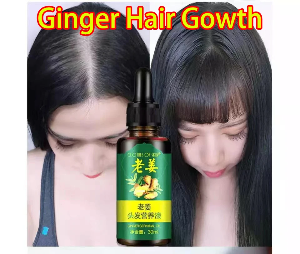 

7 Days Ginger Germinal Oil Hair Nutrient Solution Hair Growth Essence Liquid Fast Hair Natural Hair Loss Treatment Hair Care