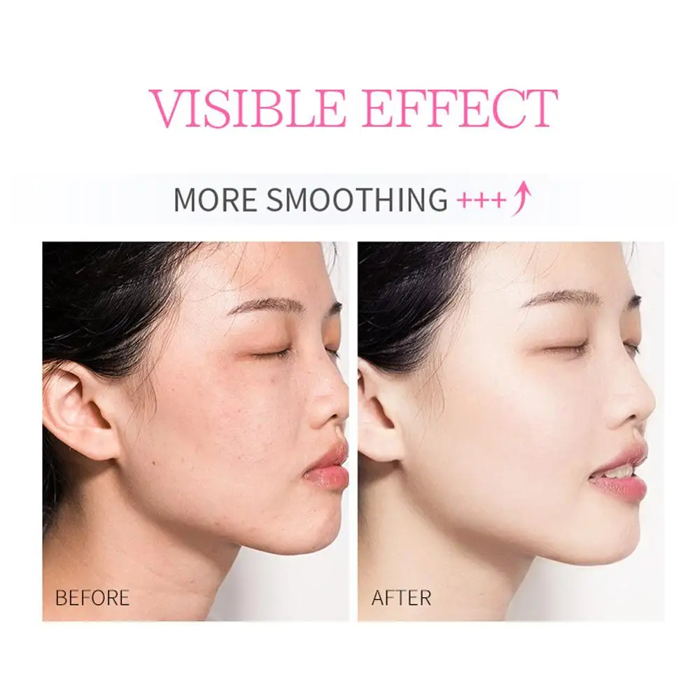 Гиалуроновая кислота уход за кожей лица улиточный крем эссенция коллагена