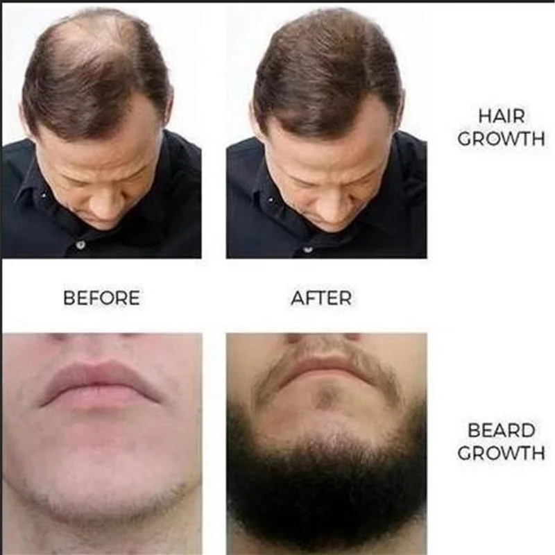 Восточные масла питание волос решения для выпадения продукт быстрого роста