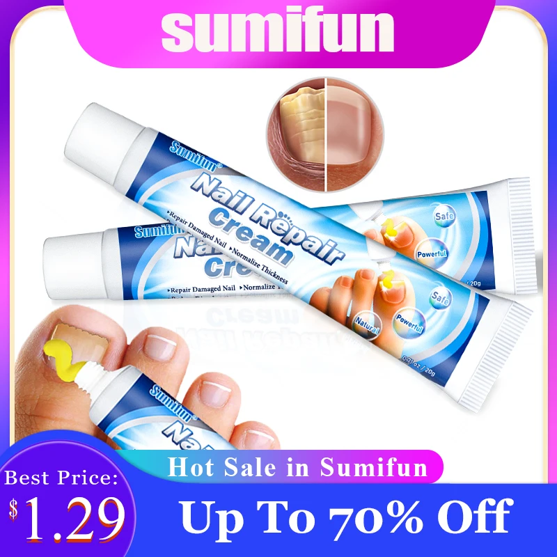 

Крем для восстановления ногтей от онихомикоза, паронихии, антибактериальная мазь для ногтей на пальцах ног, антигрибный пластырь для ухода ...