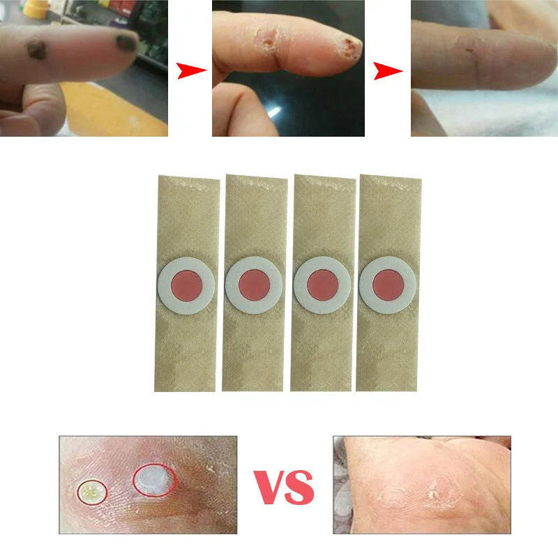 60 шт. Семья Применение стопы удалитель мозолей Фул на ногах лечения мозоли
