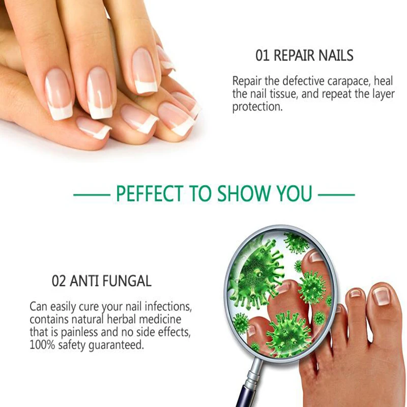 Средство для лечения Ногтей от грибков онихомикоз паронихия противогрибковая