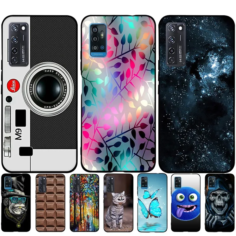 

Shell For ZTE Blade A71 Axon 20 A20 4GCase Soft TPU Phone Back Cover For ZTE A20 Axon 20 4G Blade A71 Silicone Bumper Funda Capa