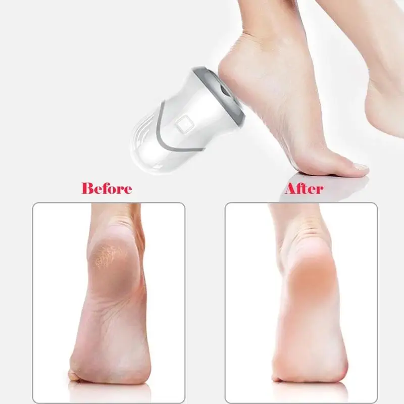 

Removing Dead Skin Grinding Feet Electric Vacuum Cleaner Multifunctional Pedicure Reduce Calluses Foot Care Device