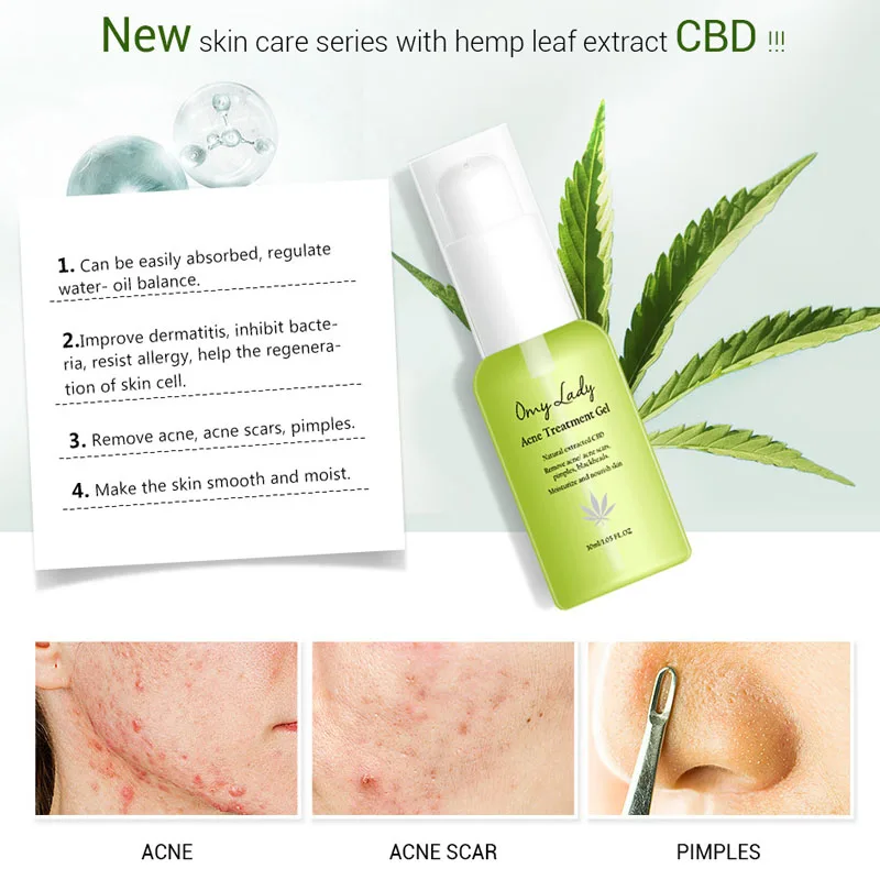 Гель для лечения акне OMY LADY Сыворотка от прыщей лицо со шрамом алоэ против