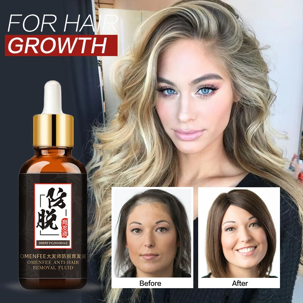 

Hair Care Hair Growth Essential Oils Essence Grow Hair Liquid Fluid Prevent Hair Loss Health Care Beauty Dense Hair Growth Serum