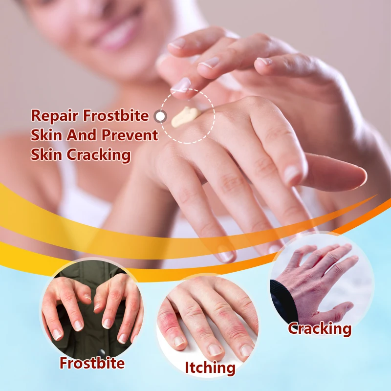 

New Sumifun 1/2Pcs Frostbite Anti-Chapping Repair Ointment Anti-Cracking Cream Anti Itching Dry Crack Moisturizer Ointment P1196