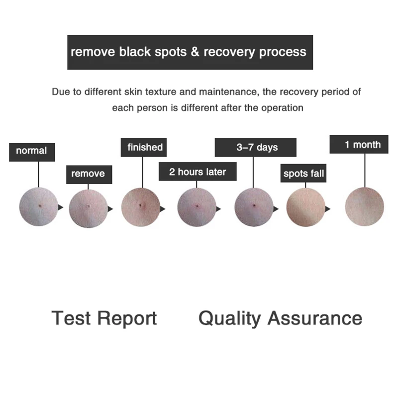 Черное средство для удаления пятен лазерная плазменная ручка 9 уровней