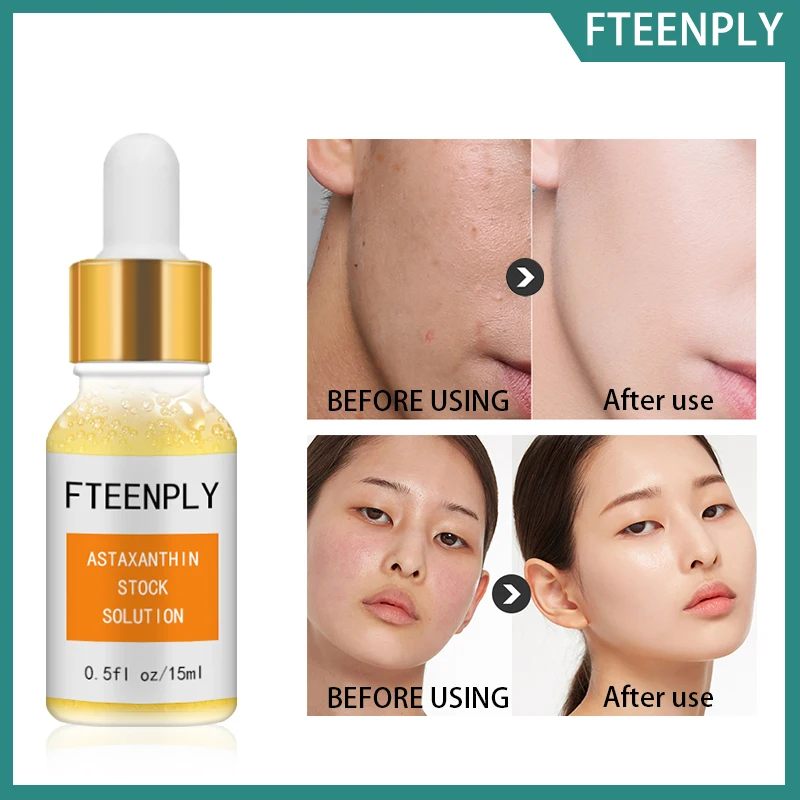 

FTEENPLY Astaxanthin Serum Facial Whitening Moisturizing Hyaluronic Acid Deep Repair Sunscreen Face Nourishing Skin Care