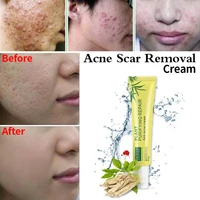 20g acne scar removal cream aloe vera gel plant extracts cleansing acne cream face skin care spots blemish marks treatment