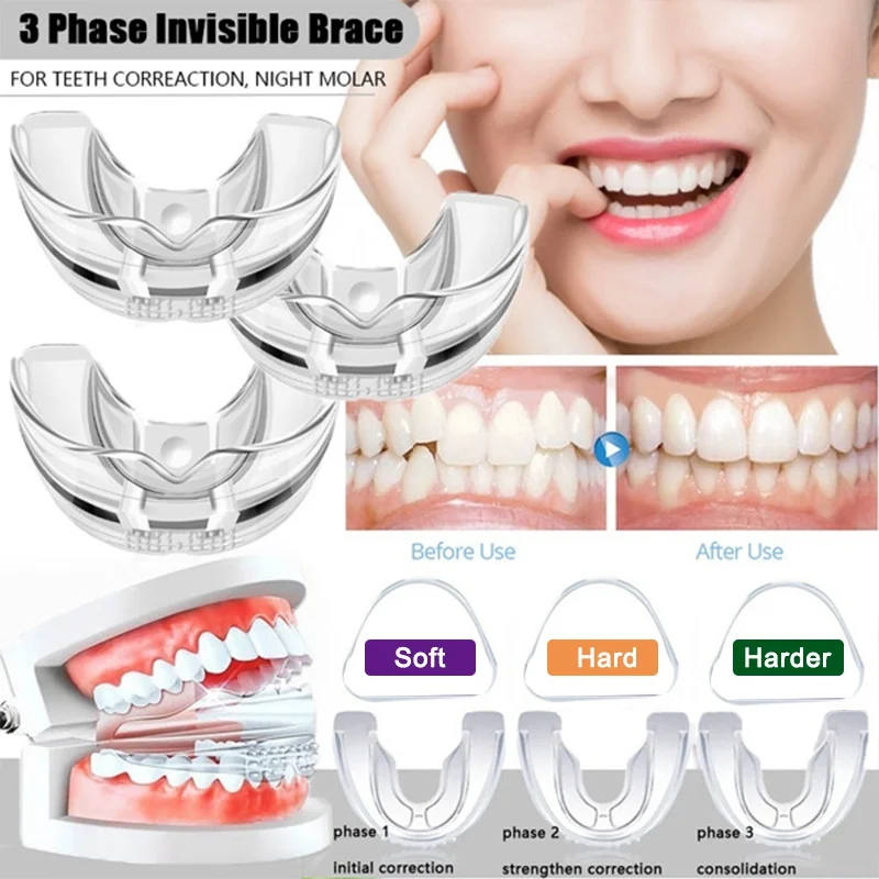 

3Stages Orthodontic Braces Dental Braces Instanted Silicone Teeth Alignment Trainer Teeth Retainer Mouth Guard Braces Tooth Tray