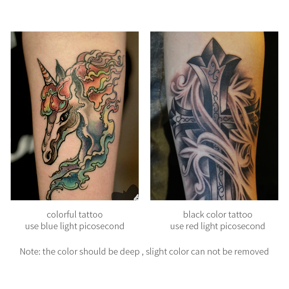 Пикосекундная ручка черная татуировка для удаления рубцов от акне крот Веснушка