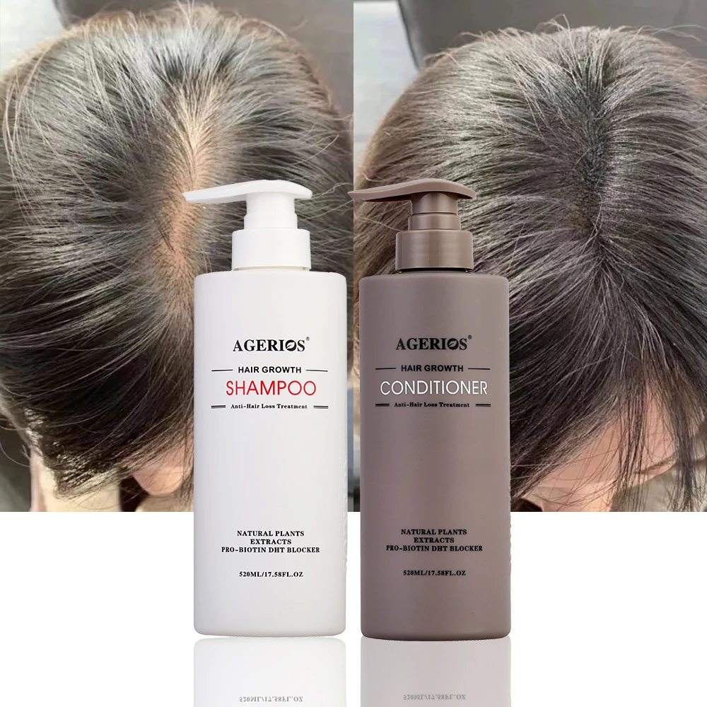 AGerios Organic Hair Regrowth Professional Shampoo And Conditioner Argan Oil For Hair Natural Anti-Hair Loss Drop Ship Wholesale