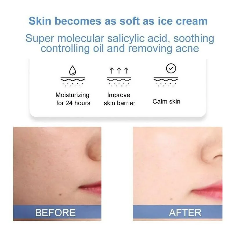 Маска для мороженого с салициловой кислотой устраняет следы прыщей удаляет