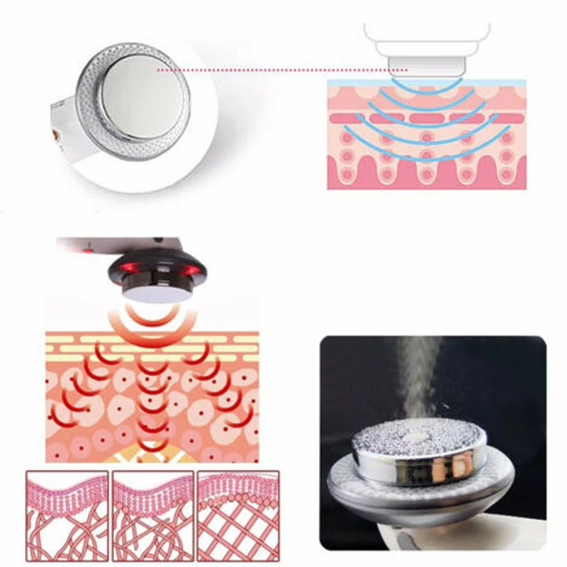 Ультразвуковая кавитационная терапия массажер для коррекции фигуры анти