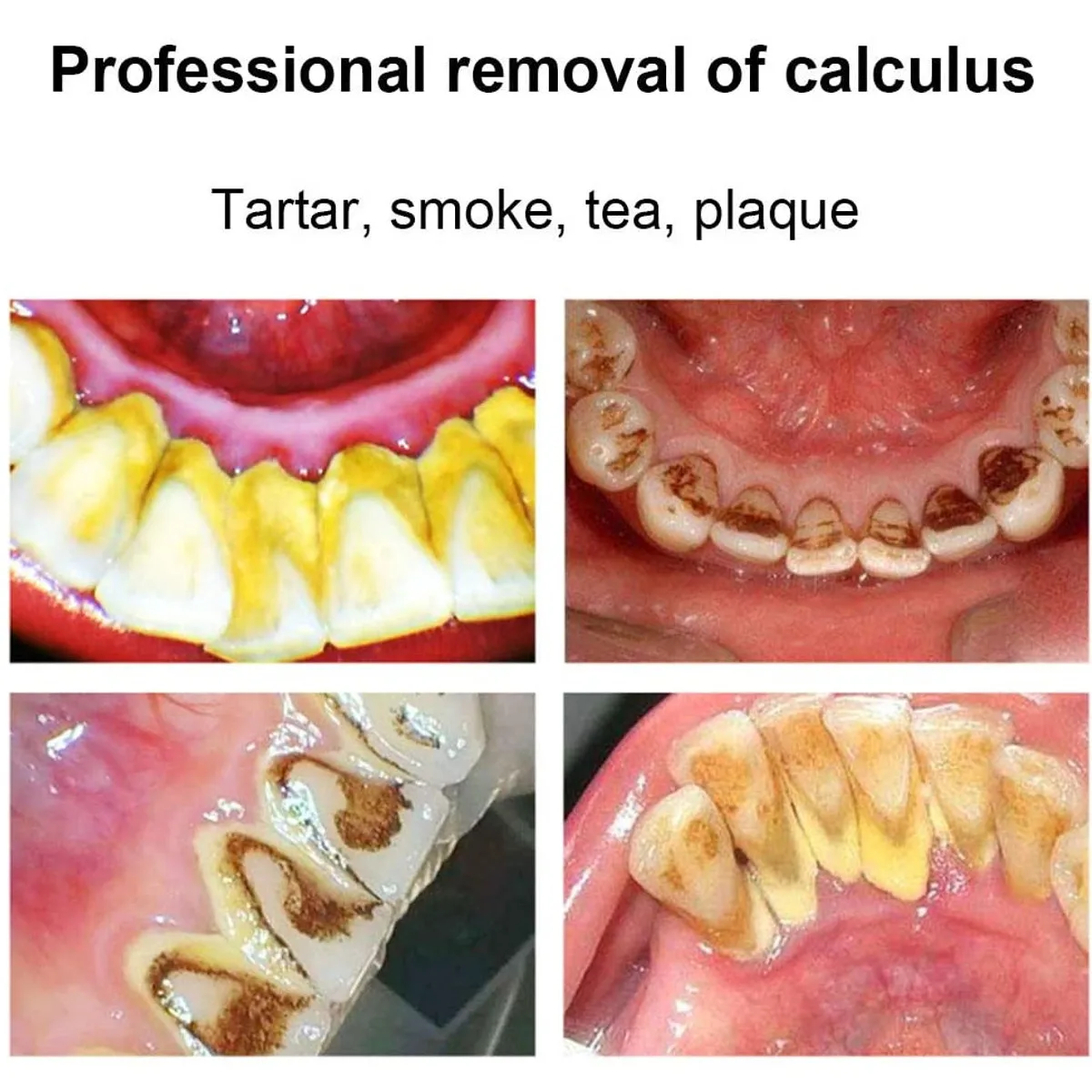 

1200t/min 75ML Portable Oral Irrigator Teeth Cleaner Water Jet Tooth Health Water Non-electric Household Portable Oral Irrigator