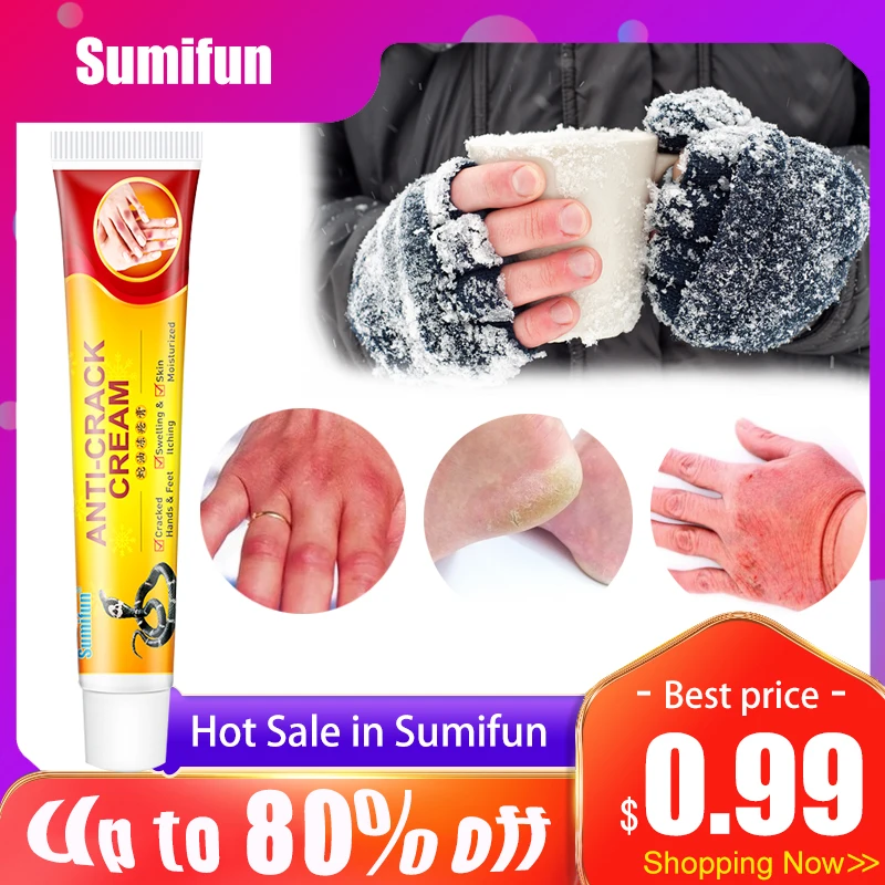 

20g Sumifun Chilblain Cream Chapped Hands Feet Moisturizing Ointment for Winter Cracked Foot Heel Skin Care Medicine Herbs China