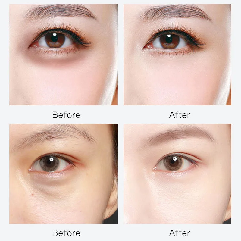 60 шт. аминокислотных прозрачных пленок для глаз мешочек гелевых черных подушечек