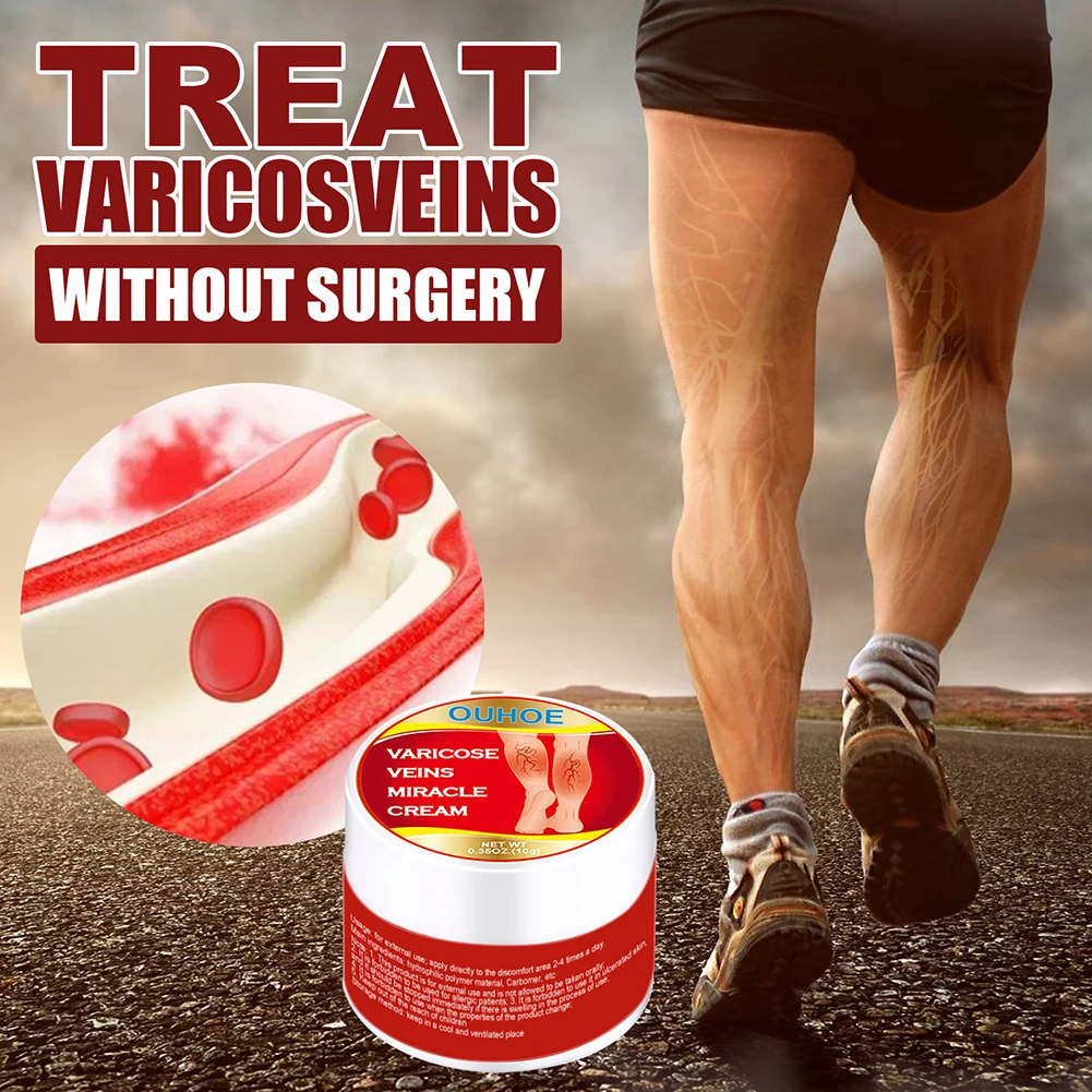 

1Pcs 10g Leg Varicose Veins Cream Thigh Spider Removal Phlebitis Vasculitis Ointment Anti Swelling Pain Relief Plaster for Body