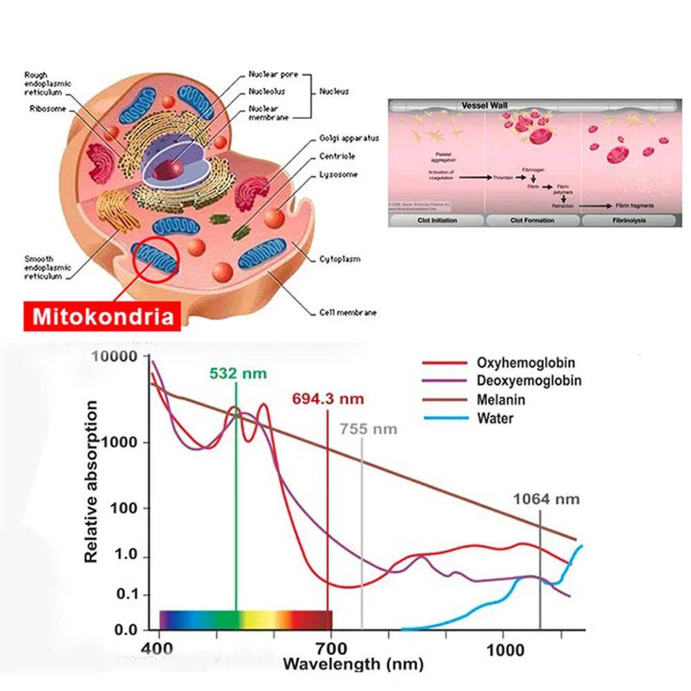 Наручные часы для лазерной терапии Нм | Красота и здоровье