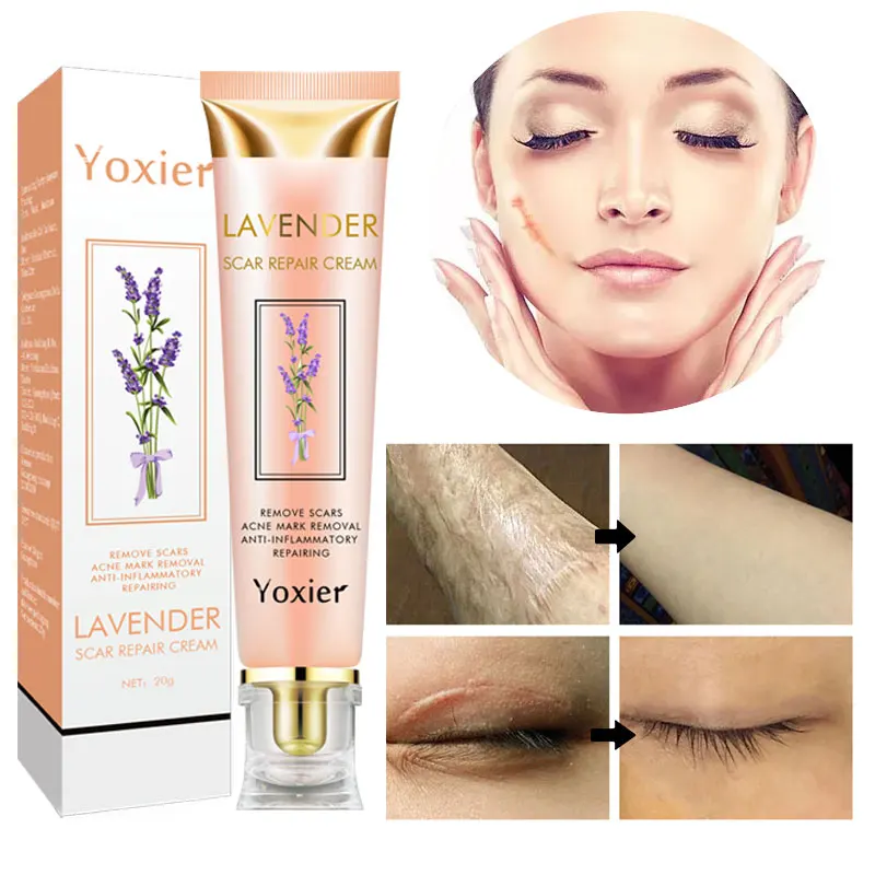 Крем для восстановления рубцов лаванды увлажняющий Лечебный крем лечения