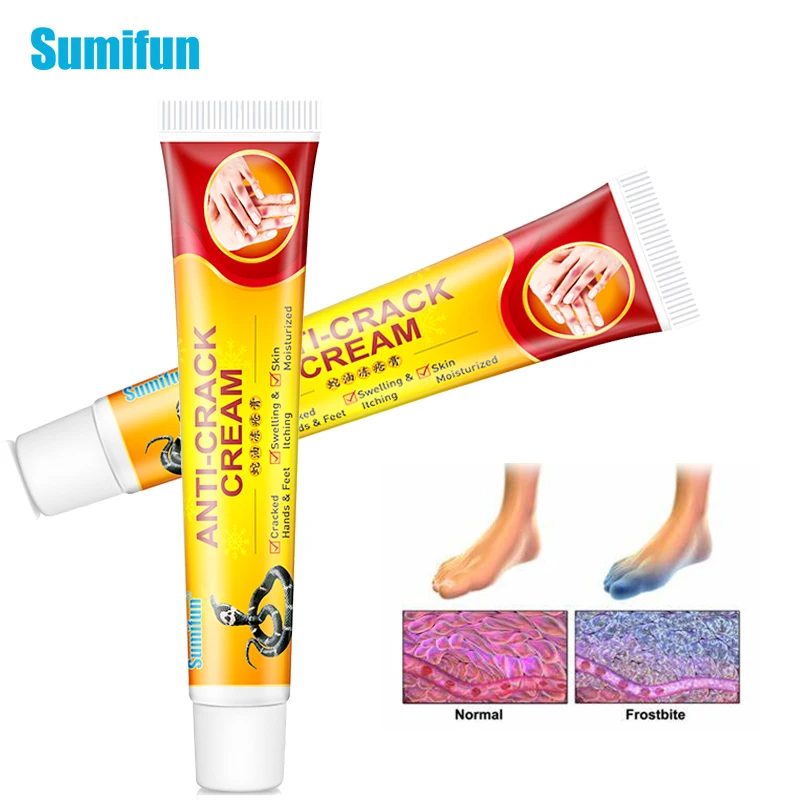 Восстанавливающий увлажняющий крем против облегания грубых и сухих