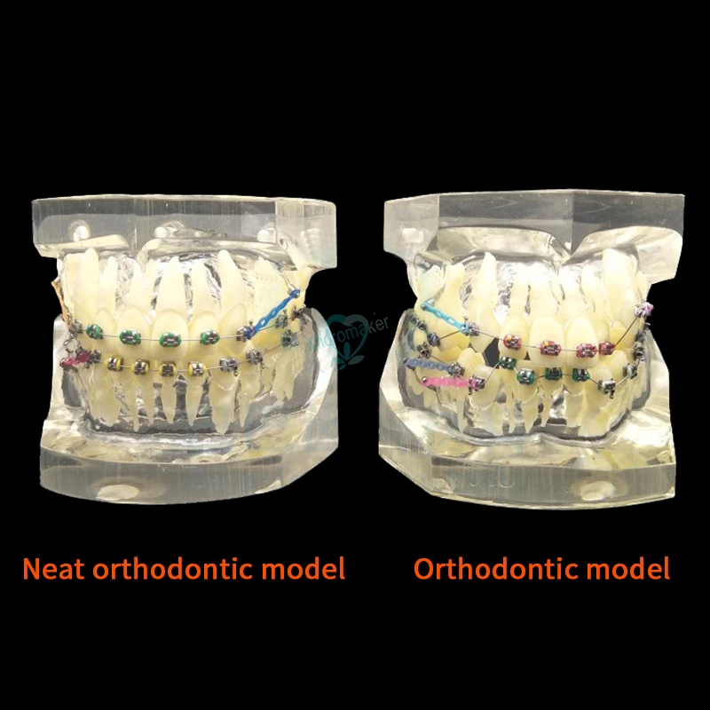 1 шт. Стоматологическая Ортодонтическая обучающая модель зубной ортодонтический