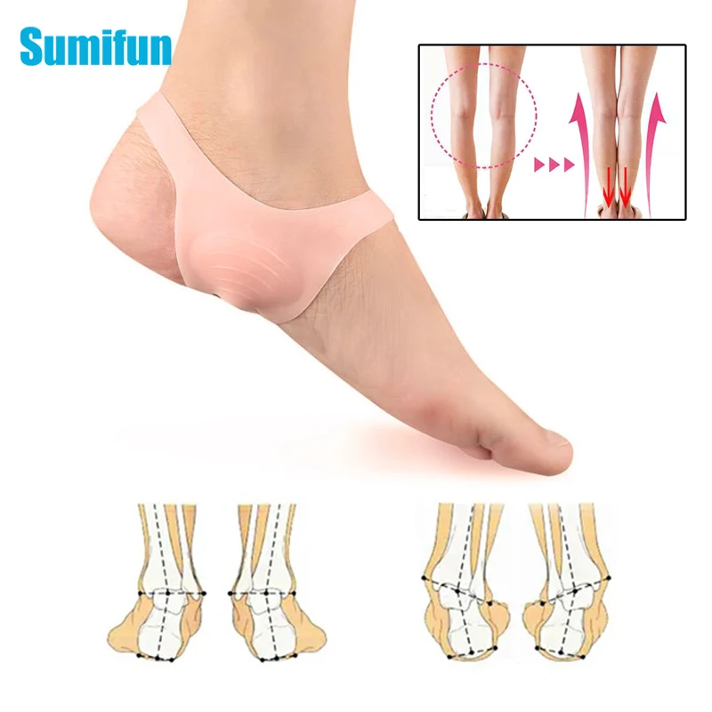 

2pcs O-type Foot Corrector Insoles Pads Straightener Sushions No Slip Shoes For Men Women Silicone Orthopedic Insoles Foot Care