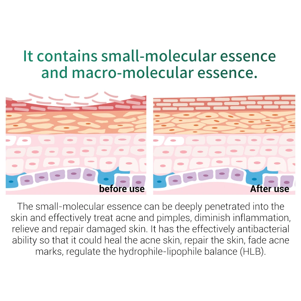 LANBENA маска для лица средство удаления черных точек сыворотка новый стиль быстрое