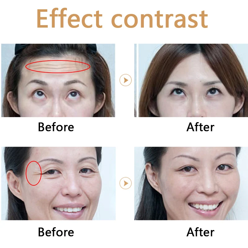 

High Pressure Hyaluronic Acid Pen Lip Injection Pen for Anti Wrinkle Lip Lifting Injection Hialuron Injecrtable Hyaluronique Pen