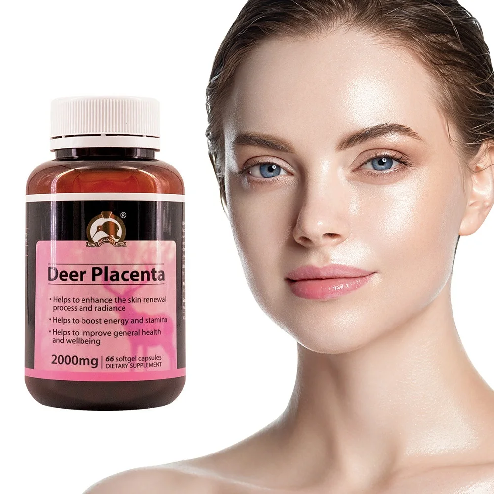 Новая Зеландия золото киви олень капсула плаценты для женщин здоровье и красота