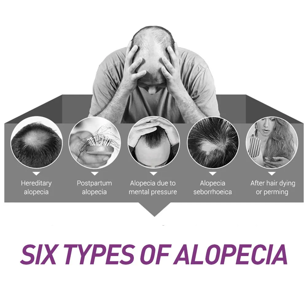 Эфирное масло для роста волос 2 шт. средство лечения выпадения эссенция ухода за