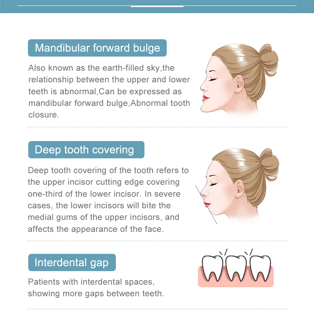 Cofoe Dental Braces Orthodontic locator Invisible orthodontic bracket For Smile Teeth Alignment Trainer and dental care With box