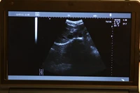 laptop ultrasound scanner b ultrasound 3 5mhz convex array probe new model for pregnant abdomen