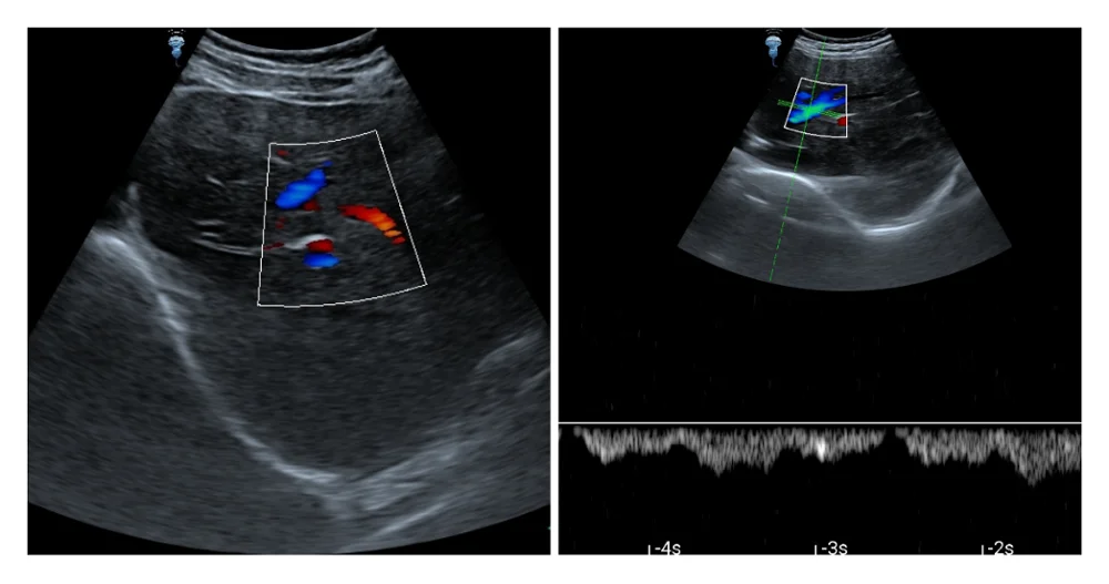 

double head color Doppler probe echographe portable ultrasound scanner