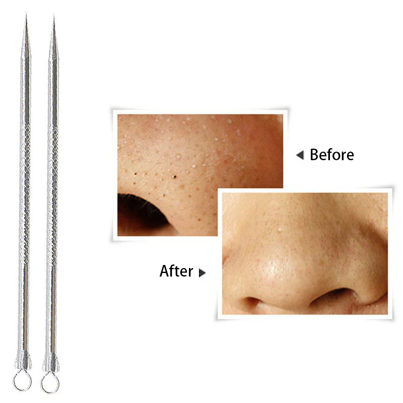 Угри для пор против акне очищающий удалить чистка лица и черных точек пятен уход