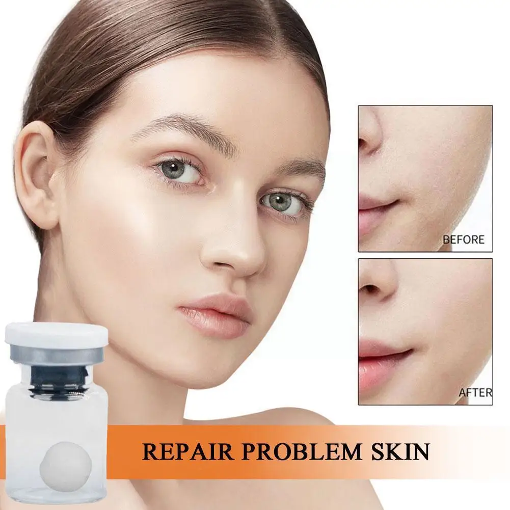 

1pcs Water-soluble Silk Shrinks Pores Fades Tightens Ball Freeze-dried Collagen Ball Anti W4u9