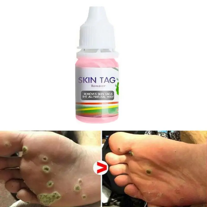 10 мл средство для удаления клеток кожи жидкий натуральный растительный экстракт